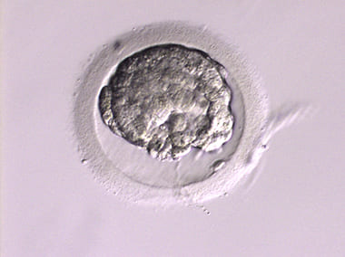 採取後胚